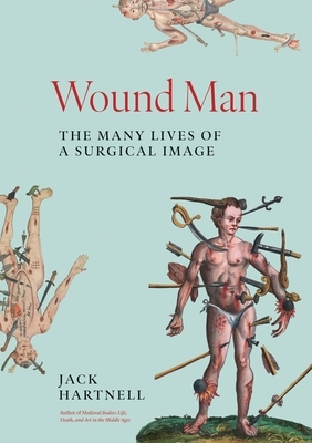 Wound Man: The Many Lives of a Surgical Image